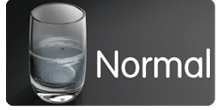puntos-calientes-normal